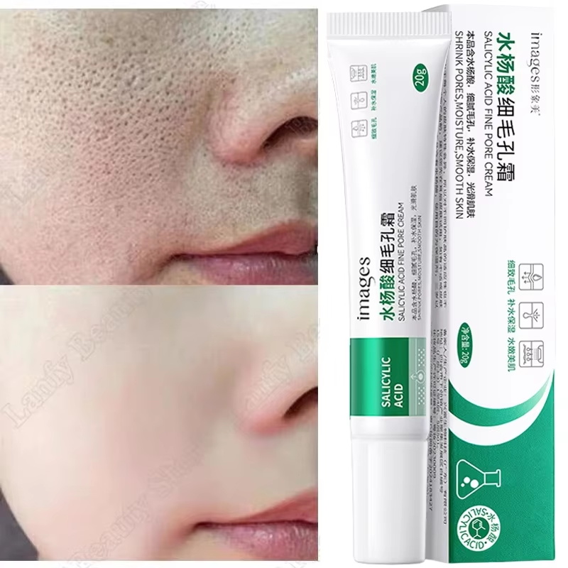 Salicylic Acid Blackhead Remover - Salicylzuur Poriënreinigende Crème Verkleint Poriën Verwijdert